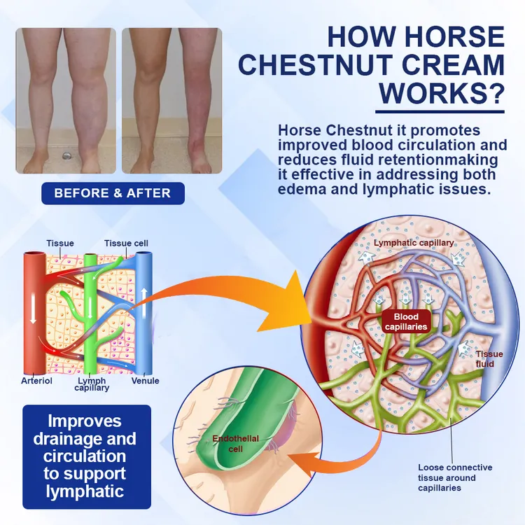 Tired, Swollen, or Heavy Legs? NESLEMY™ Restores Freedom of Movement!